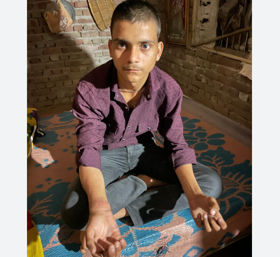 Agra: High School Student Beaten at Police Outpost, Arm Fractured; Two Sub-Inspectors Suspended