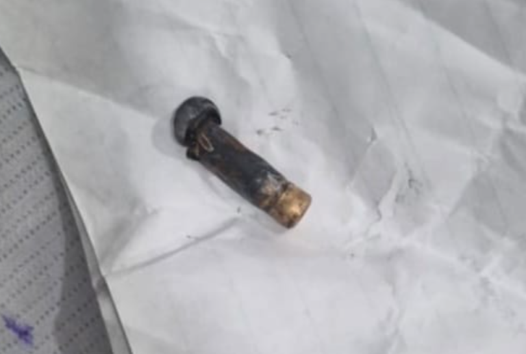 Used Cartridge Found Lodged In Teen Girl’s Head, Condition Critical
